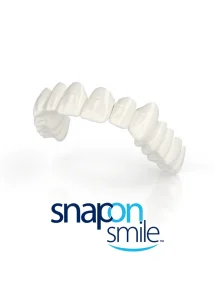 snap on smile opinie